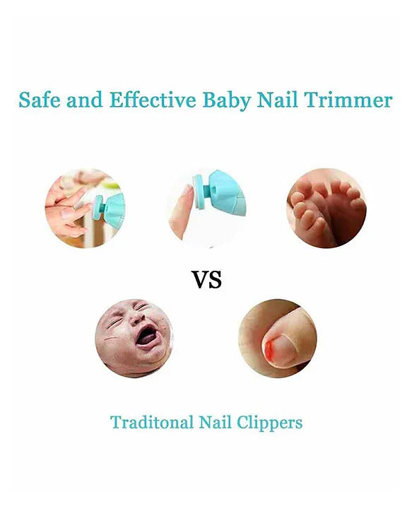 Baby Nail Trimmer Kit – Whisper-Quiet & Safe Nail Care for Little Ones 🌟